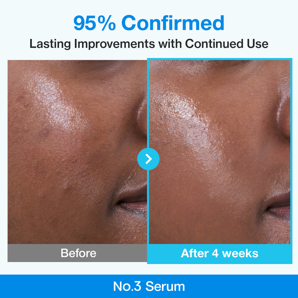 سرم جمعکننده منافذ نامبوزین No.3 Blue Bio-Retinol