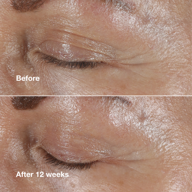 کرم دور چشم ضد چروک کلینیک Smart Clinical Repair